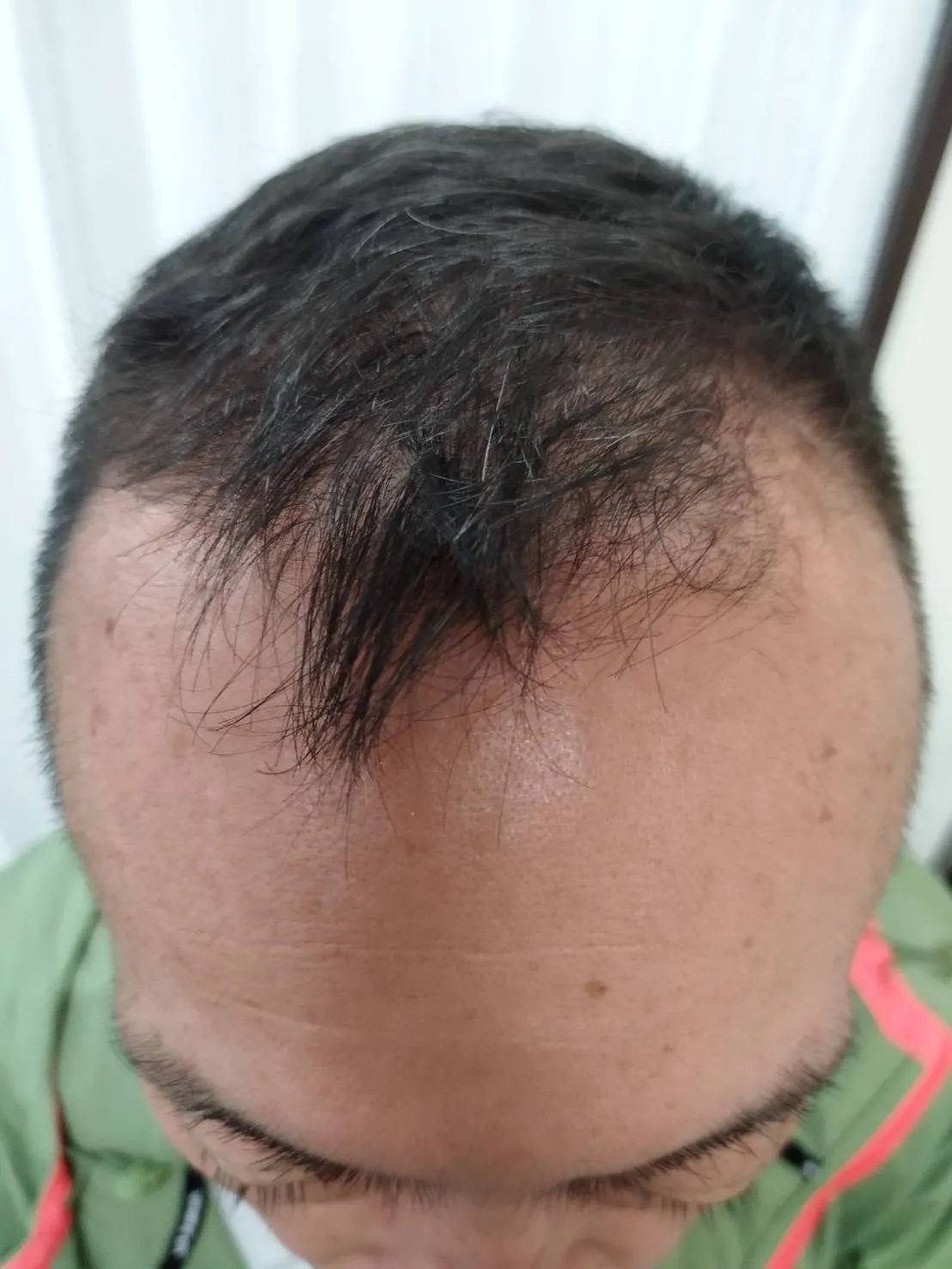 After