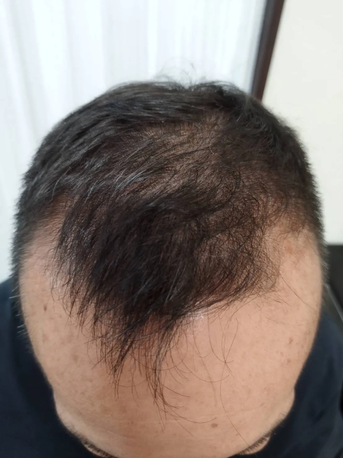 Before